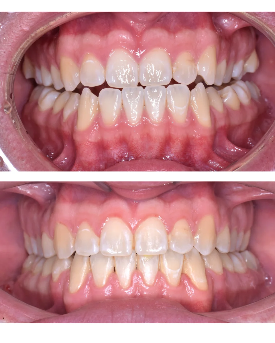 Paciente 1 - Detalle 2