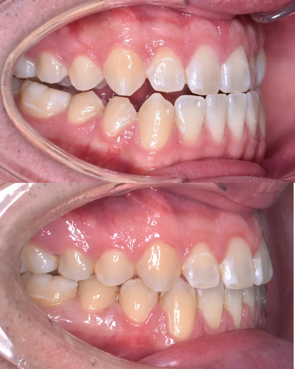 Paciente 1 - Detalle 3
