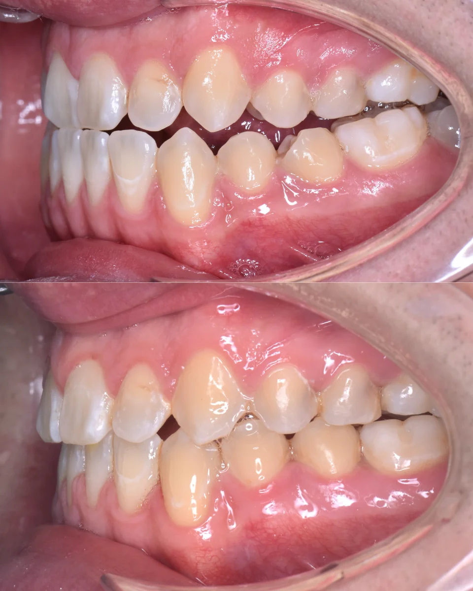 Paciente 1 - Detalle 4