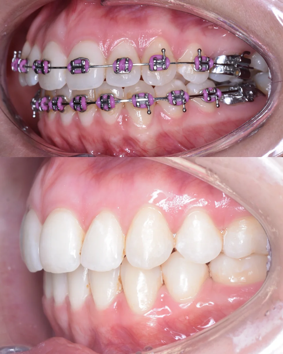Paciente 3 - Control 4